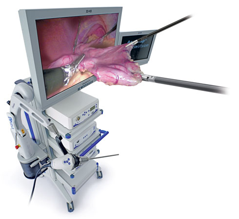 3D laparoskop (ilustrační obrázek)