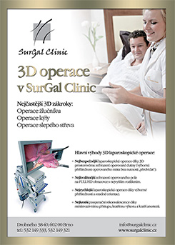 3D laparoskopie