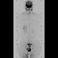 Snímek celotělového MRI